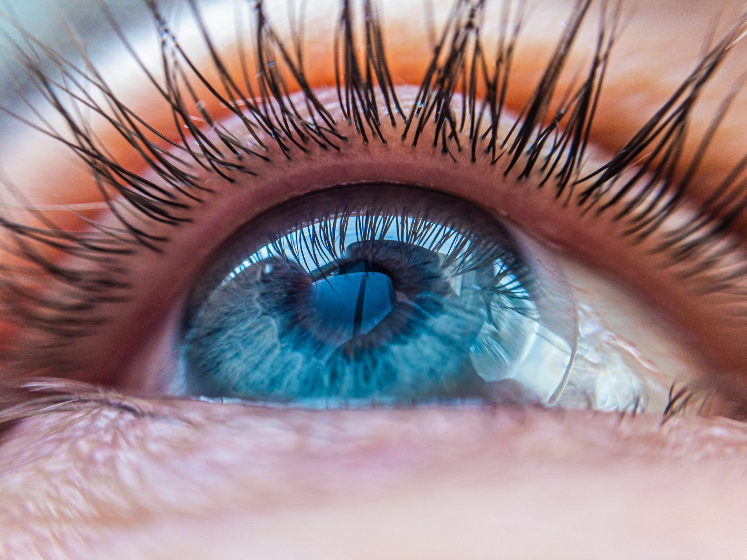 scleral lens on eye scleral lens on eye