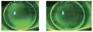 sphere (left) versus toric (right)
